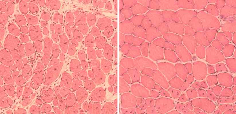 Komórki mięśniowe myszy, starzejące się po lewej i odmłodzone po prawej, Fot. Juan Carlos Izpisua Belmonte Lab/Salk Institute