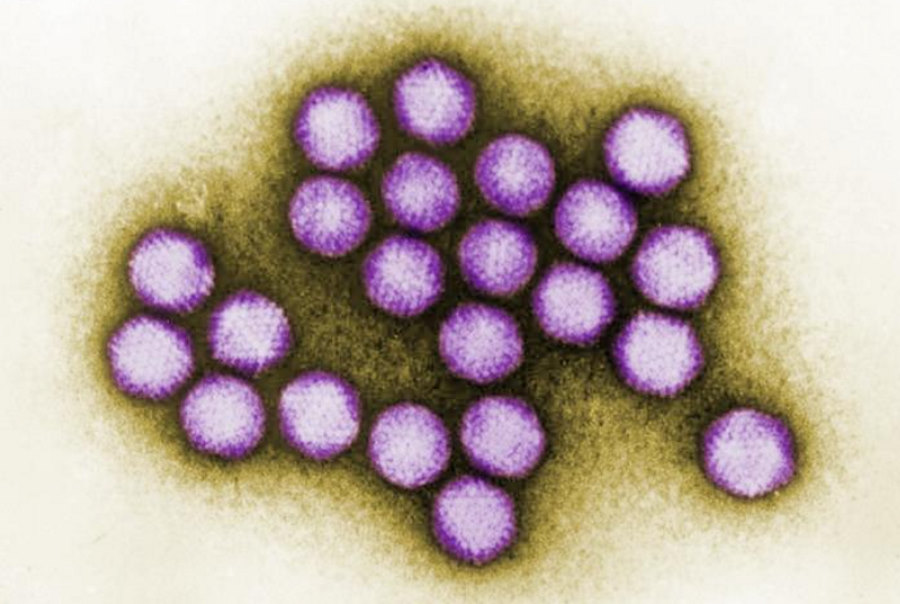 Wirusy wywołujące przeziębienie istniały na długo przed pojawieniem się współczesnego człowieka