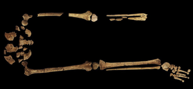 Amputacja nogi sprzed 31 tys. lat