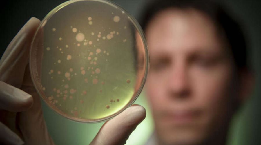 Hodowla bakterii na szalce Petriego