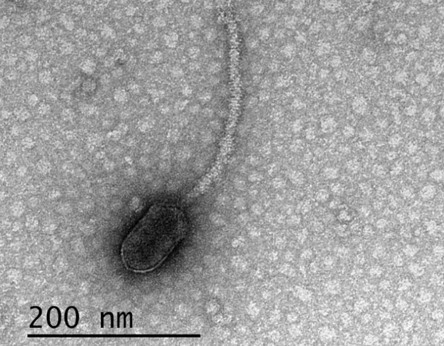 Naukowcy sugerują, że wirusy mogą nas „obserwować” i czekać na dogodną okazję do ataku