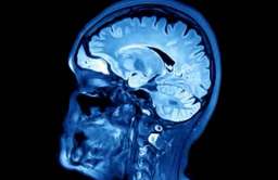 Obraz mózgu MRI