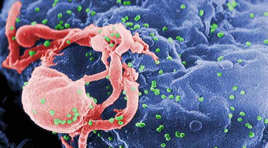 Obraz z mikroskopu elektronowego pączkującego wirusa HIV-1