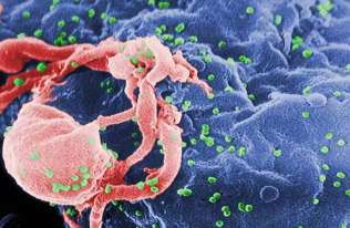 Obraz z mikroskopu elektronowego pączkującego wirusa HIV-1