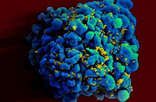 Obiecujące wyniki eksperymentalnej szczepionki mRNA przeciwko HIV