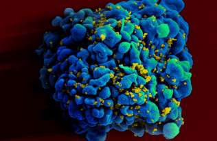 Drugi w historii przypadek, w którym układ odpornościowy człowieka sam pokonał wirusa HIV