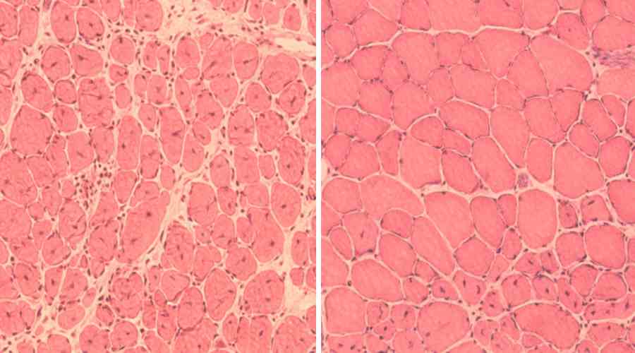 Komórki mięśniowe myszy pokazujące odwrócenie procesu starzenia