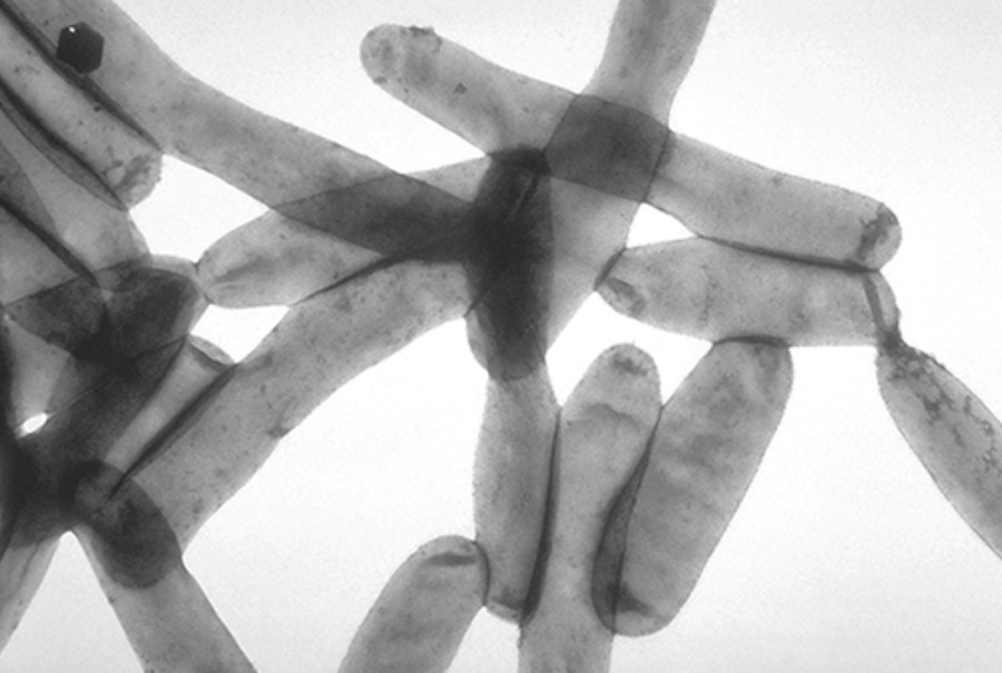 Pulmonolog: Legionella nie jest groźna dla większości zdrowych osób