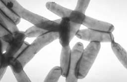 Pulmonolog: Legionella nie jest groźna dla większości zdrowych osób