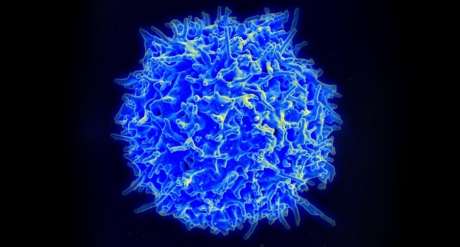 Limfocyt T