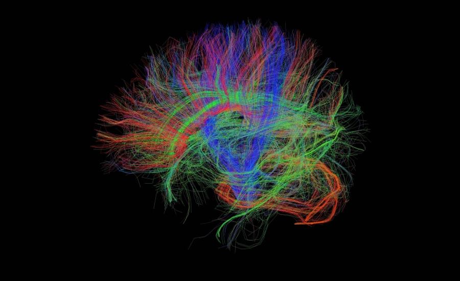Obrazowanie mózgu metodą rezonansu magnetycznego z dyfuzją