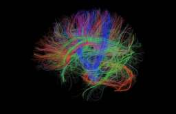 Obrazowanie mózgu metodą rezonansu magnetycznego z dyfuzją