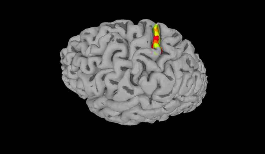 Obraz mózgu pokazujący miejsce implantacji w korze czuciowej