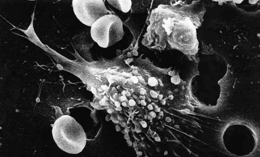 Śmierć komórki nowotworowej