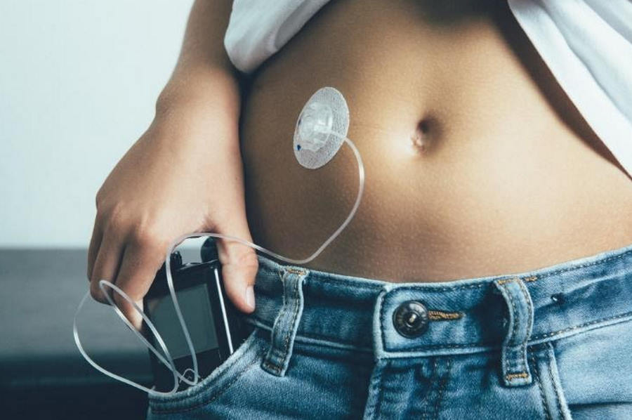 Pompa insulinowa – czym jest i jak działa?
