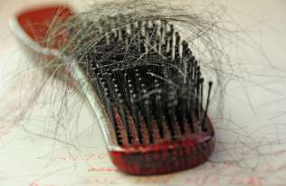 Naukowcy ustalili, dlaczego stres powoduje utratę włosów. Nowa nadzieja dla łysiejących