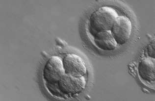 Naukowcy stworzyli z komórek macierzystych małpy struktury przypominające zarodki