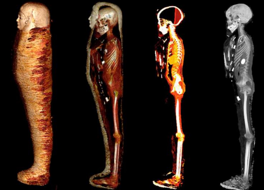 Sekrety mumii „złotego chłopca”. Tomografia ujawniła 49 ukrytych amuletów